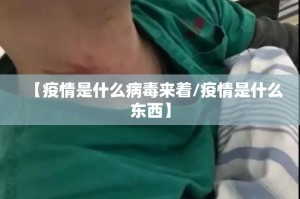 【疫情是什么病毒来着/疫情是什么东西】