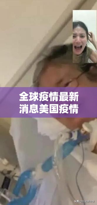全球疫情最新消息美国疫情防控:全球疫情最新消息美国疫情最新消息4月5日