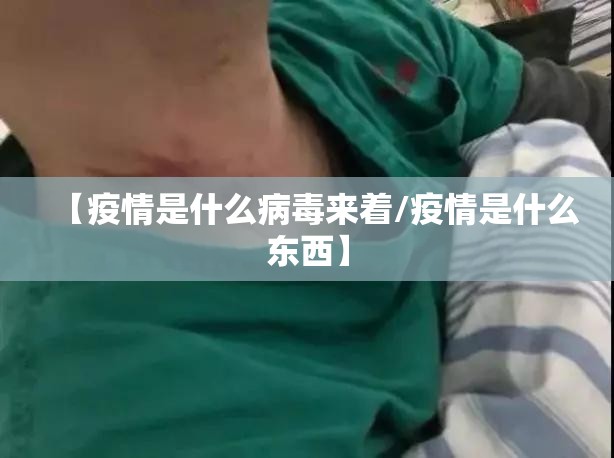 【疫情是什么病毒来着/疫情是什么东西】