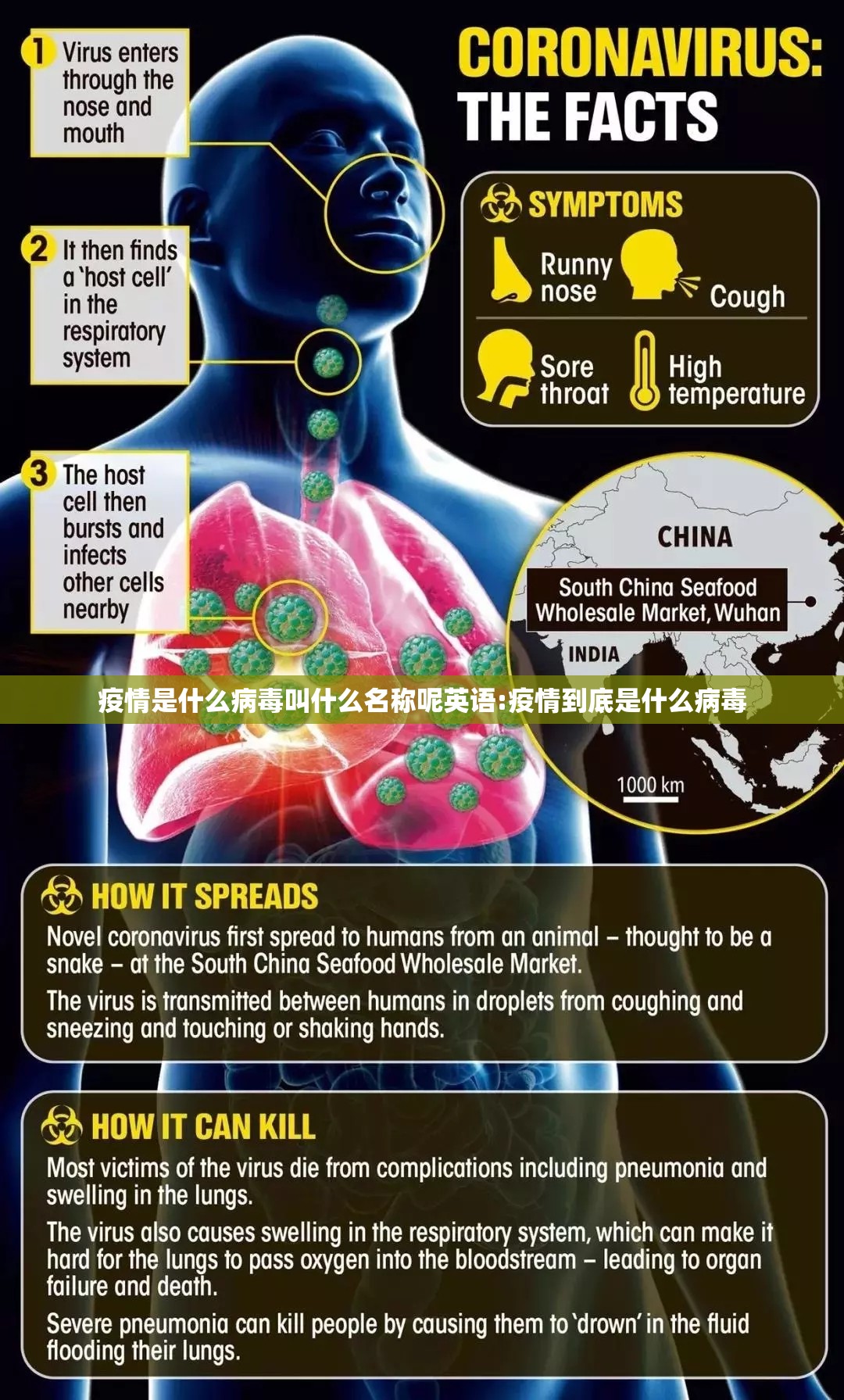 疫情是什么病毒叫什么名称呢英语:疫情到底是什么病毒